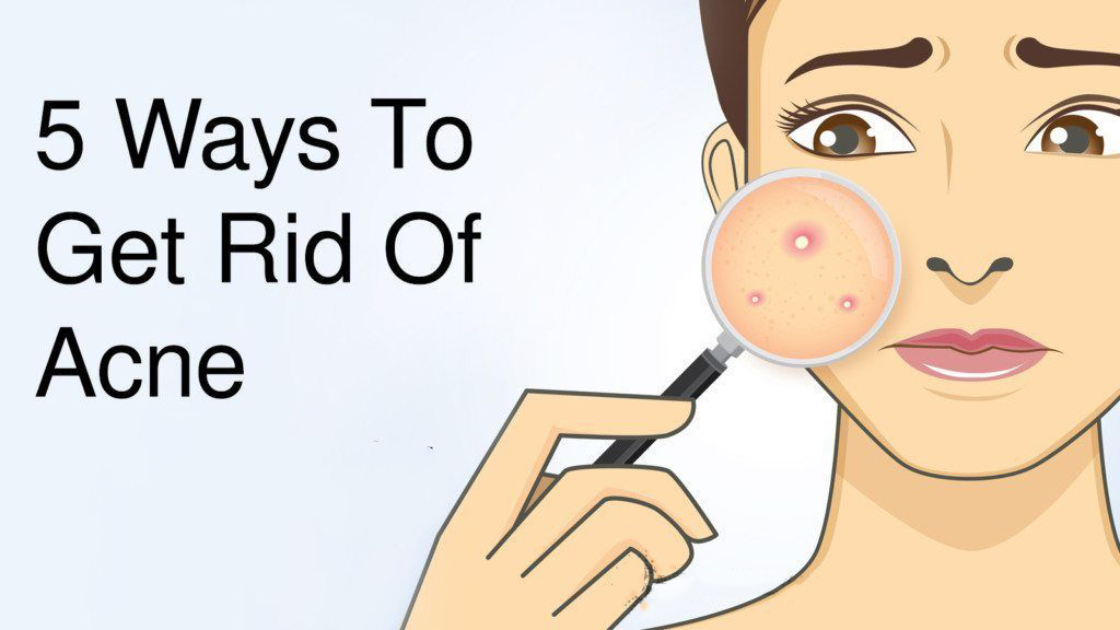 Best Way to Get Rid of Acne